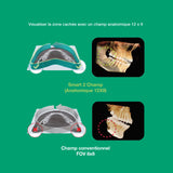 Système d’imagerie CT & panoramique 3D / 2D - Smart 2 - Vatech - oofti.fr