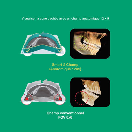 Système d’imagerie CT & panoramique 3D / 2D - Smart 2 - Vatech - oofti.fr