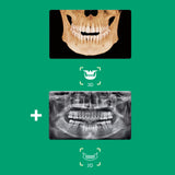 Système d’imagerie CT & panoramique 3D / 2D - Smart 2 - Vatech - oofti.fr