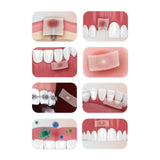 Absorbable Intraoral Dressing Bona-aid Box of 20 - Waldent