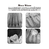 Capteur intra-oral X-ray sensor | Xpect Vision - oofti.fr