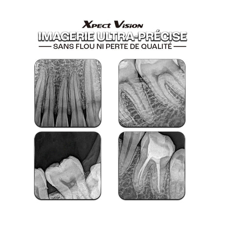 Capteur intra-oral X-ray sensor | Xpect Vision - oofti.fr