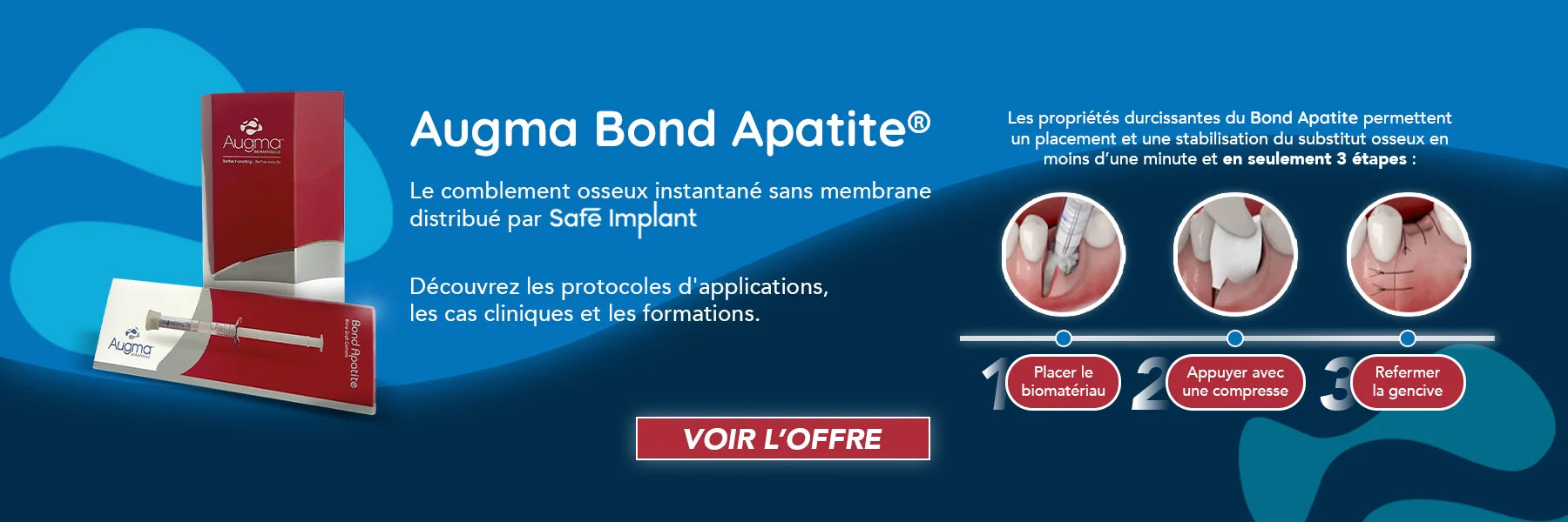 Augma bond apatite - oofti.fr