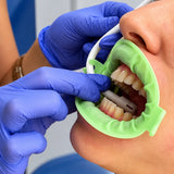 Separador dental en forma de O - Cotisen