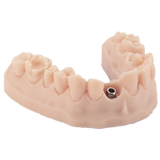 3D-Druckharz für Zahnmodelle 1 kg – DENTAL MODEL HP - ArmaResin