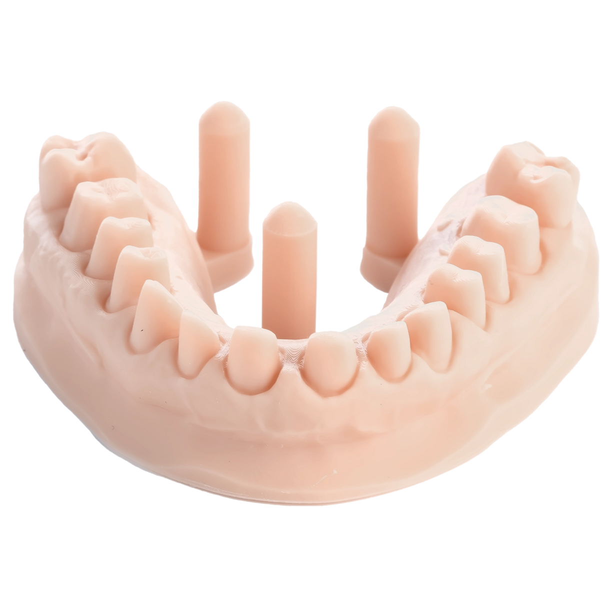 3D-Druckharz für Zahnmodelle 1 kg – DENTAL MODEL HP - ArmaResin