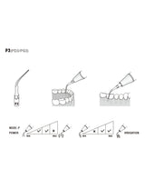 Insert P3 compatible EMS  ultrarésistant UR - WOODPECKER - oofti.fr