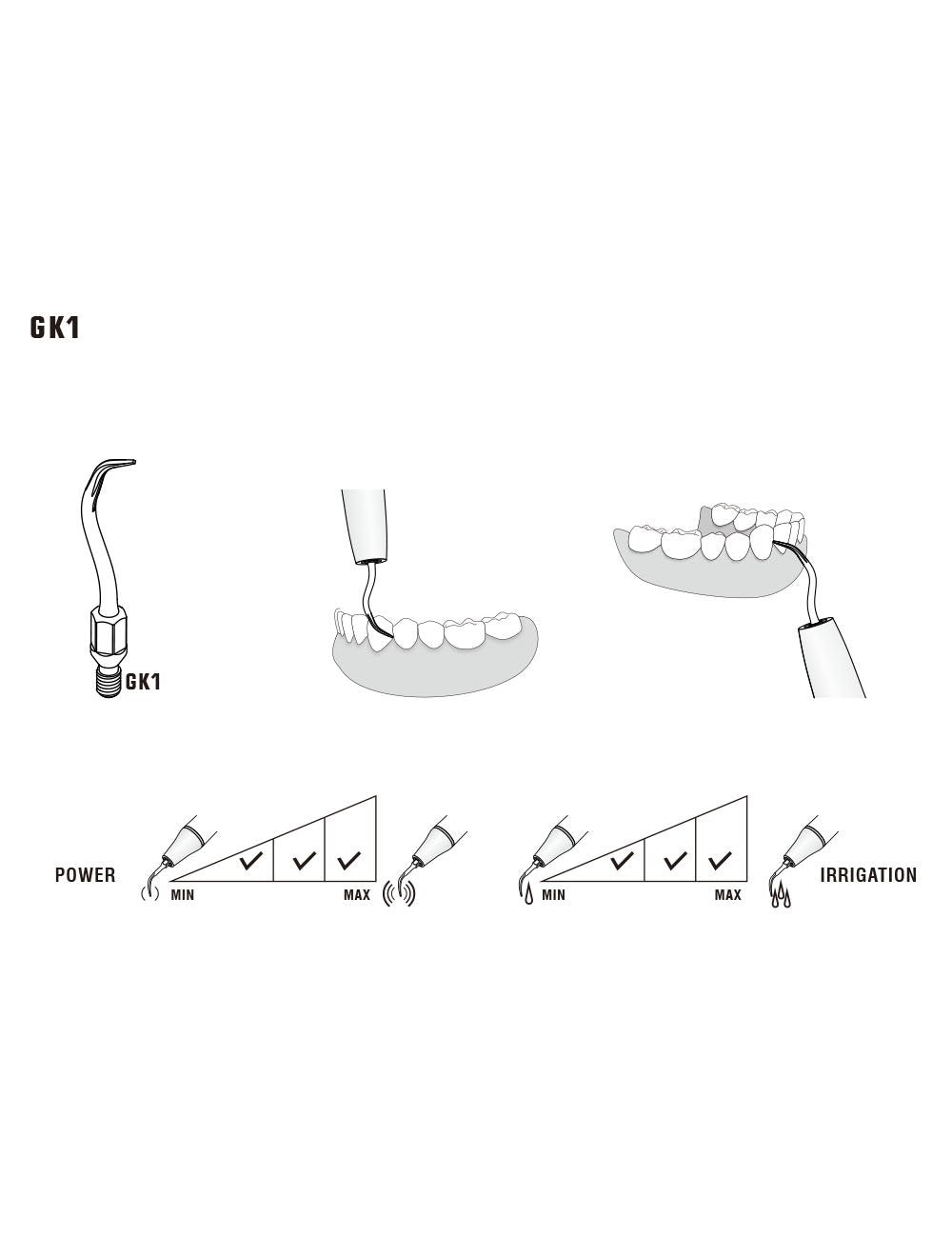 Insert GK1 compatible KAVO  UltraResistant UR - WOODPECKER - oofti.fr