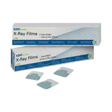 Films périapicaux - Kent Dental