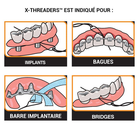 X-Threaders - oofti.fr