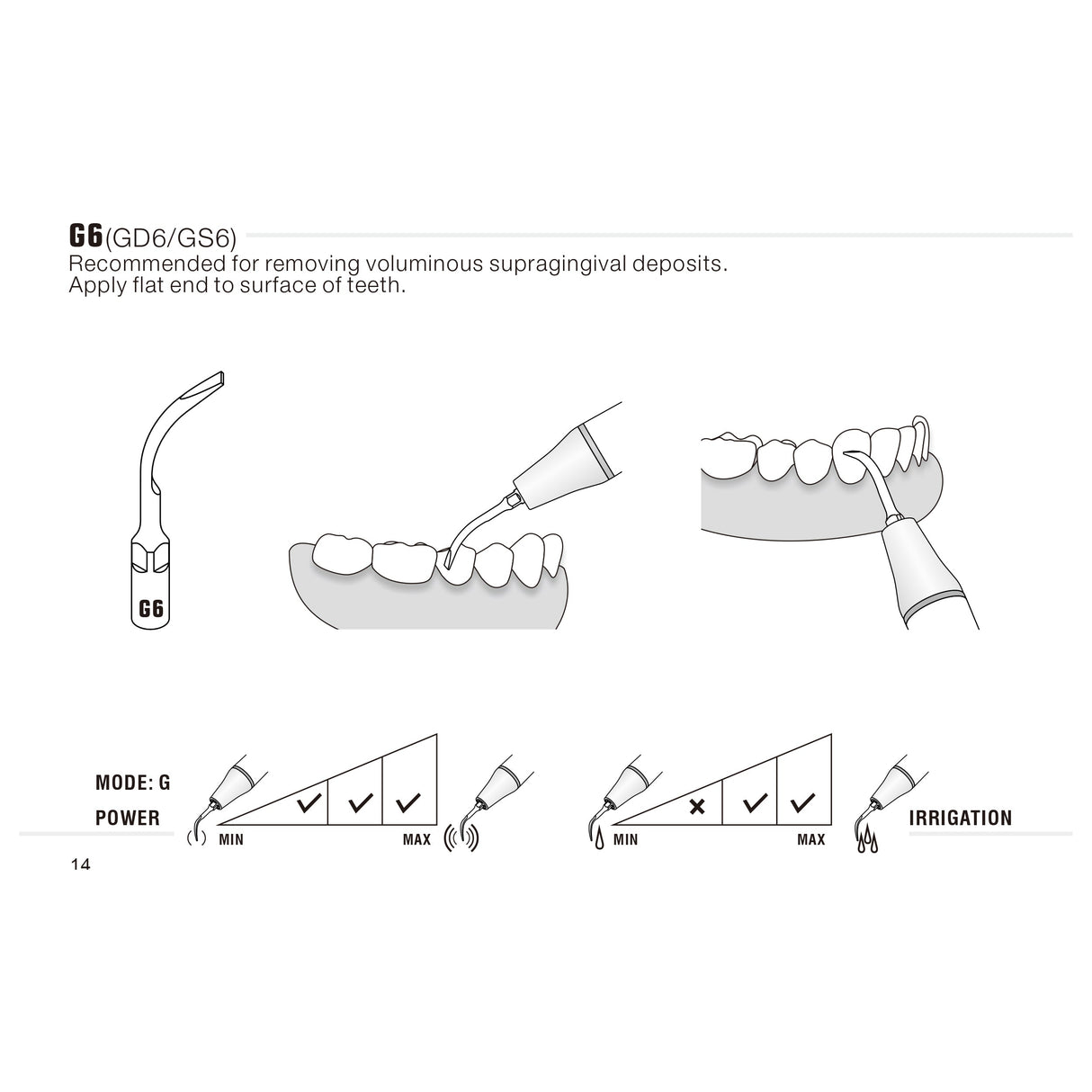 Insert G6 compatible EMS ultrarésistant UR - WOODPECKER - oofti.fr