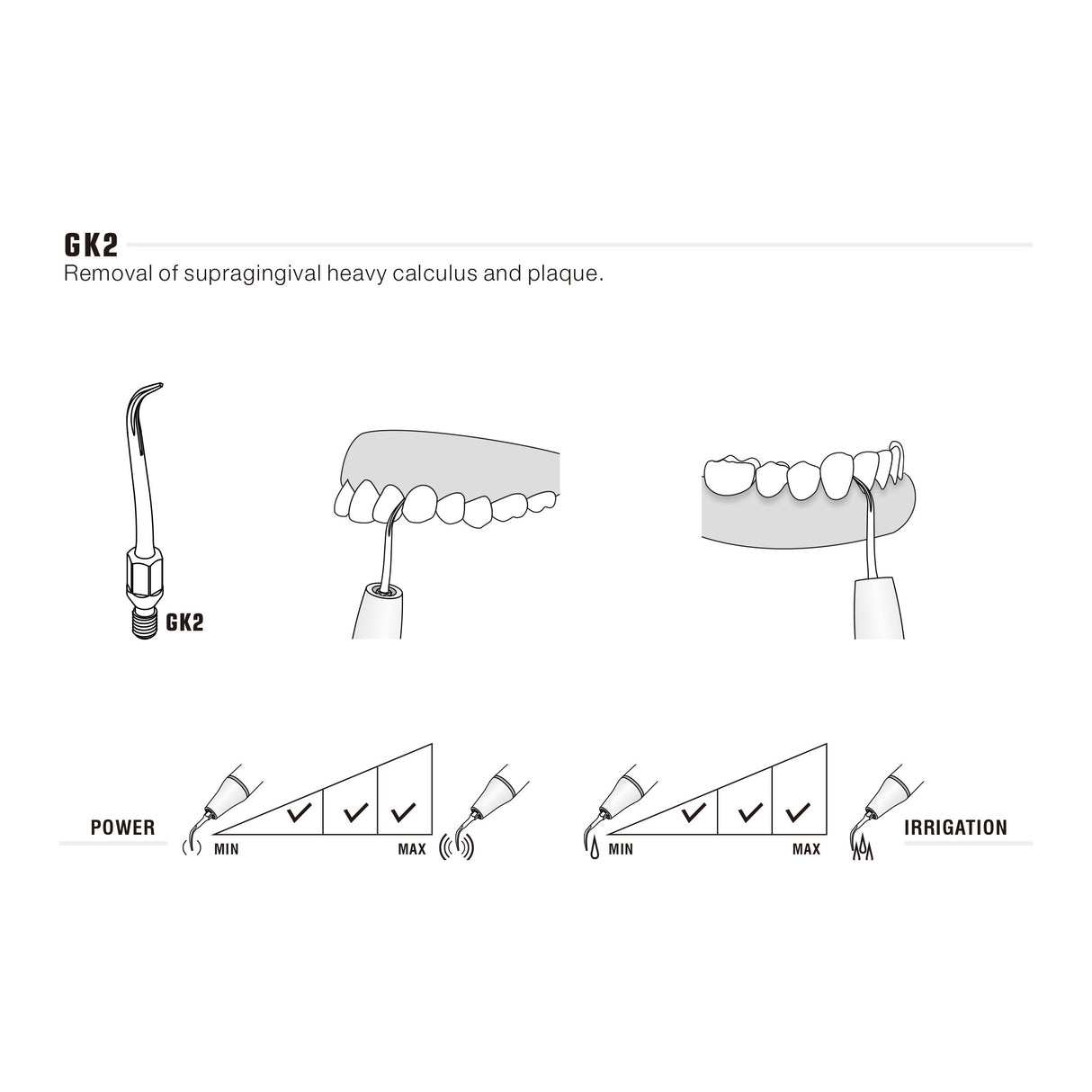Insert GK2 compatible KAVO UltraResistant UR