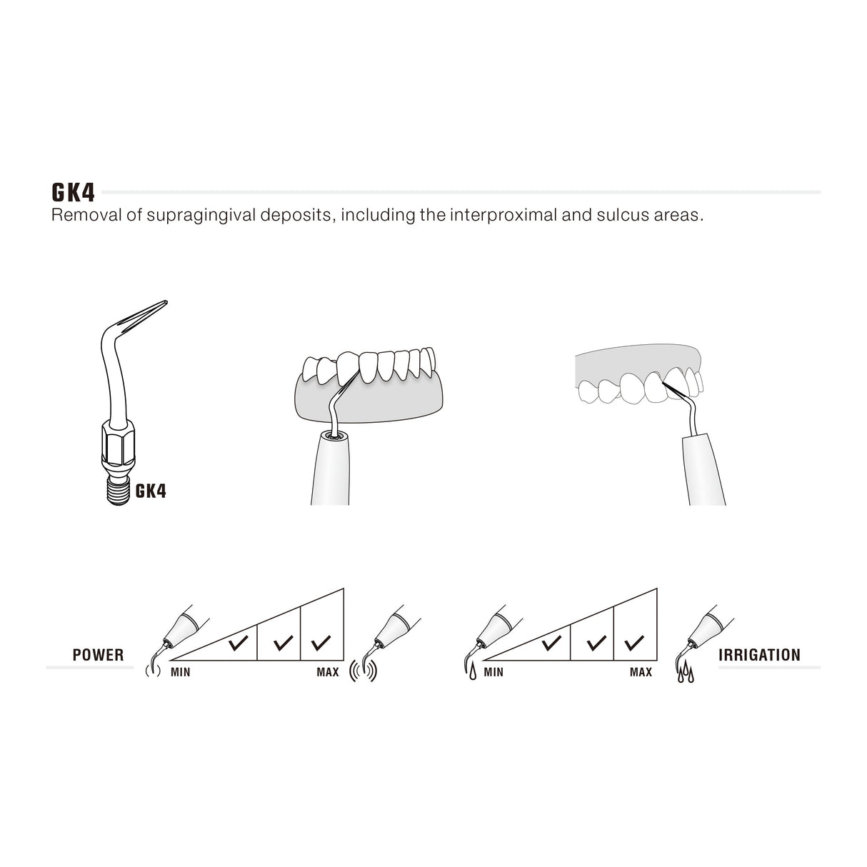 Insert GK4 compatible KAVO UltraResistant UR - oofti.fr
