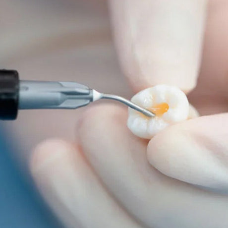 TrusFIL-Flow - Composite de restauration fluide - 2 g/seringue - HUGE - TrusFIL-Flow - Composite de restauration fluide - 2 g/seringue - HUGE - oofti.fr