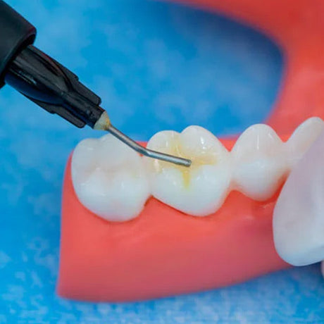 TrusFIL-Flow - Composite de restauration fluide - 2 g/seringue - HUGE - TrusFIL-Flow - Composite de restauration fluide - 2 g/seringue - HUGE - oofti.fr