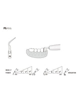 Insert P5 compatible EMS ultrarésistant UR - WOODPECKER - oofti.fr