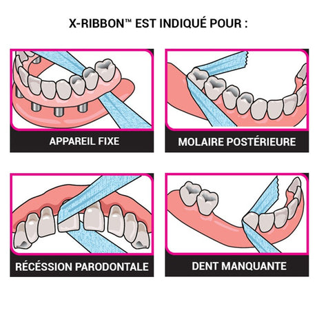X-Ribbon - oofti.fr