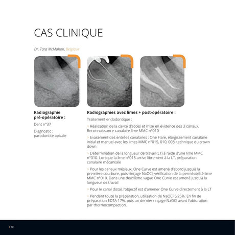 Lot de 6 limes One Curve - 4% conicité MicroMega - Dental Coop