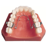 Quad-Helix - 3M Unitek